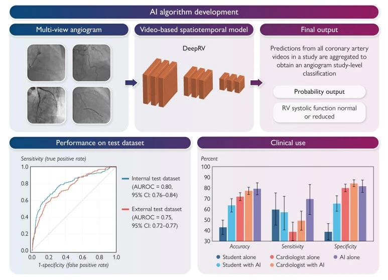 Graphical abstract: DeepRV reads multi-view angiogram videos and aggregates the predictions into one study-level probability. Bottom: test-set ROC curves and the reader study.